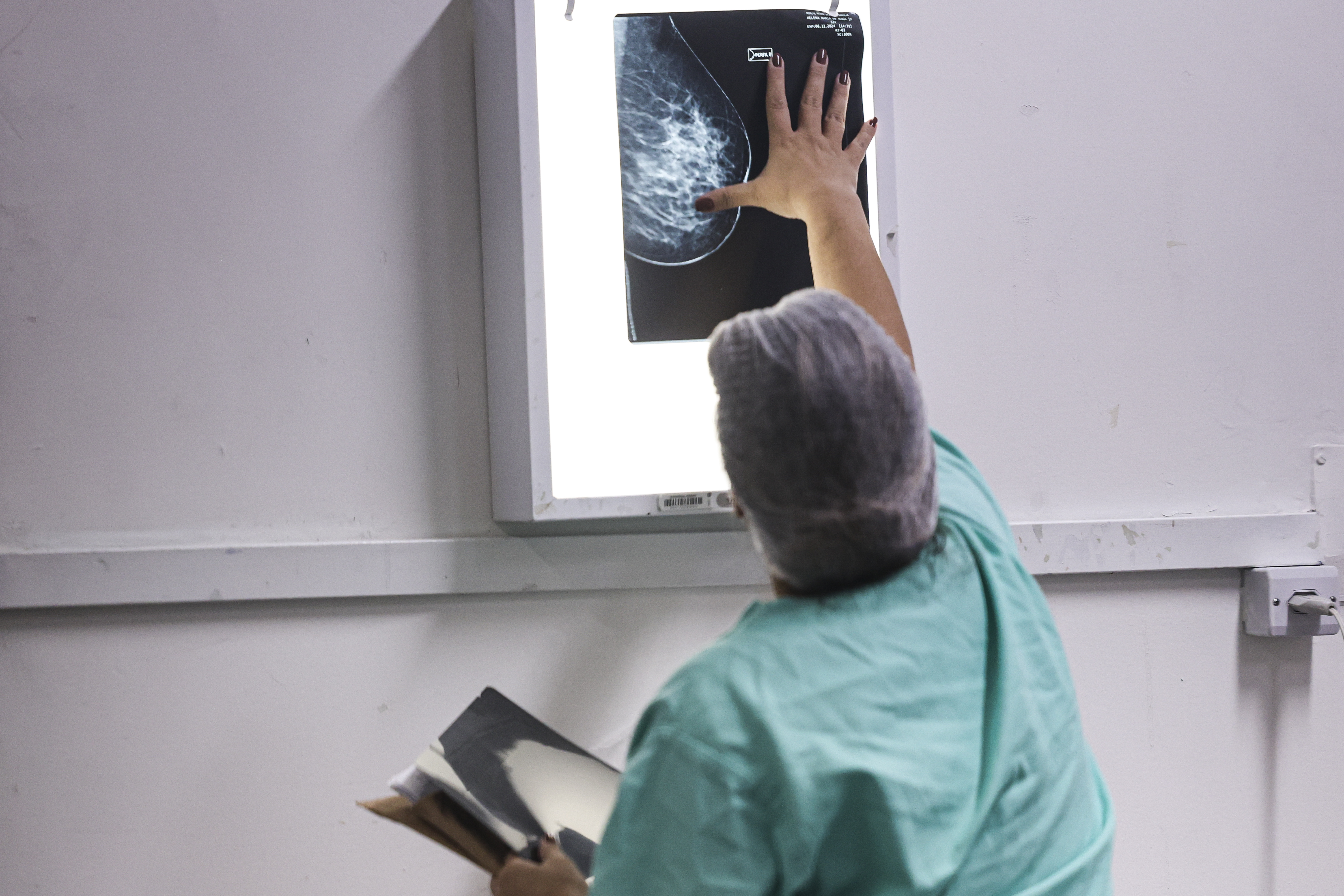 Tecnólogo em Radiologia e a democratização da saúde pública 